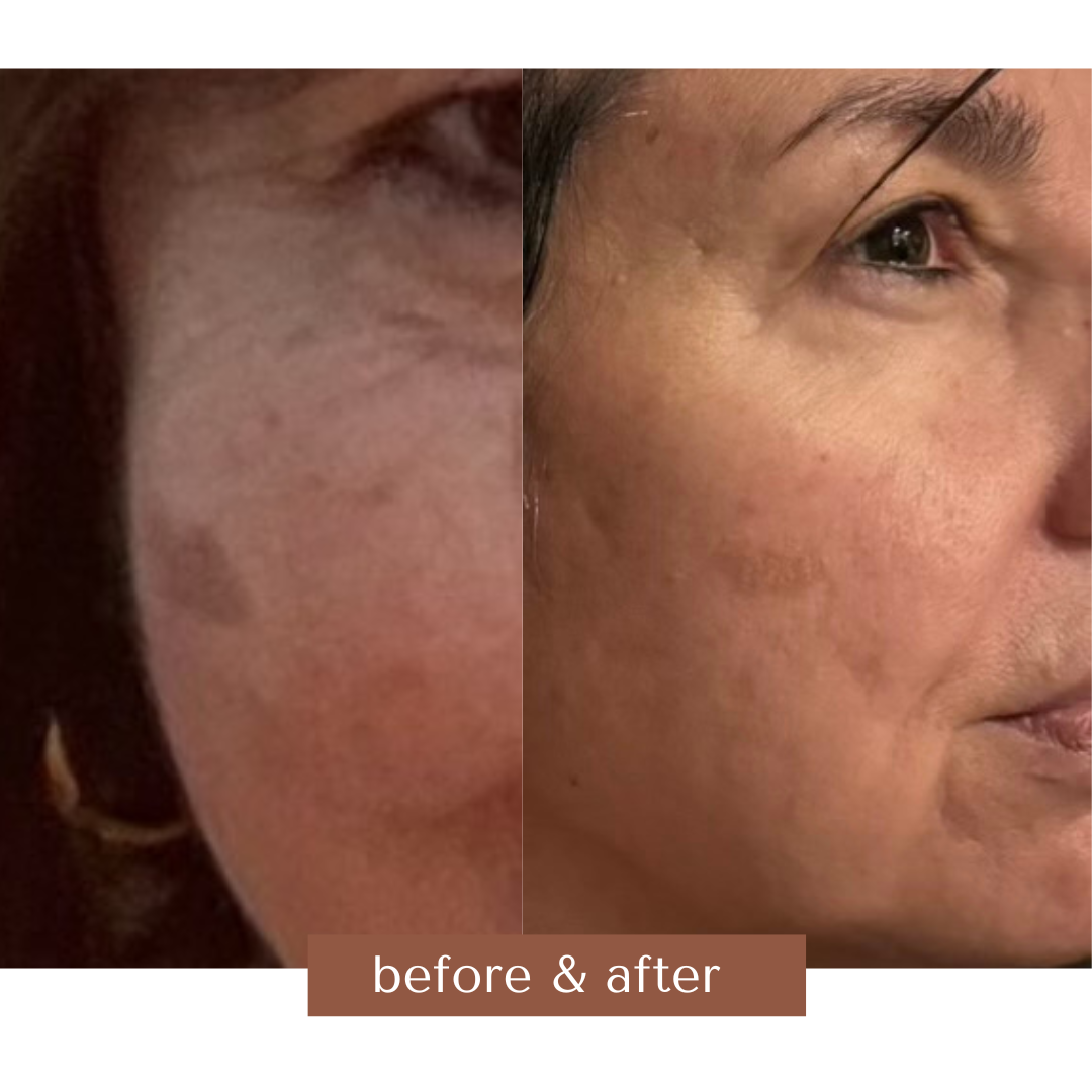 all-natural-mushroom-skincare-nature-based-beauty-hongo-skin